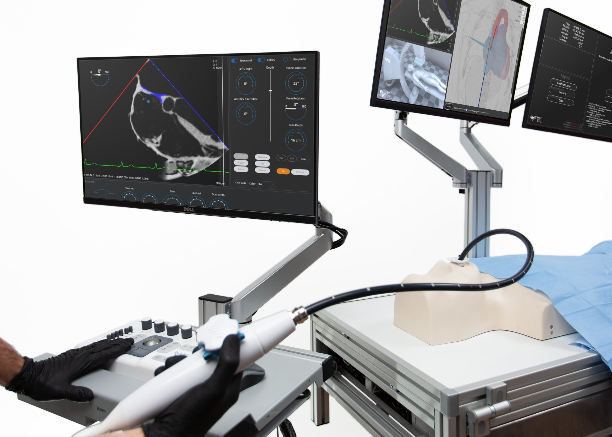 Ultrasound Simulator, Healthcare Simulation